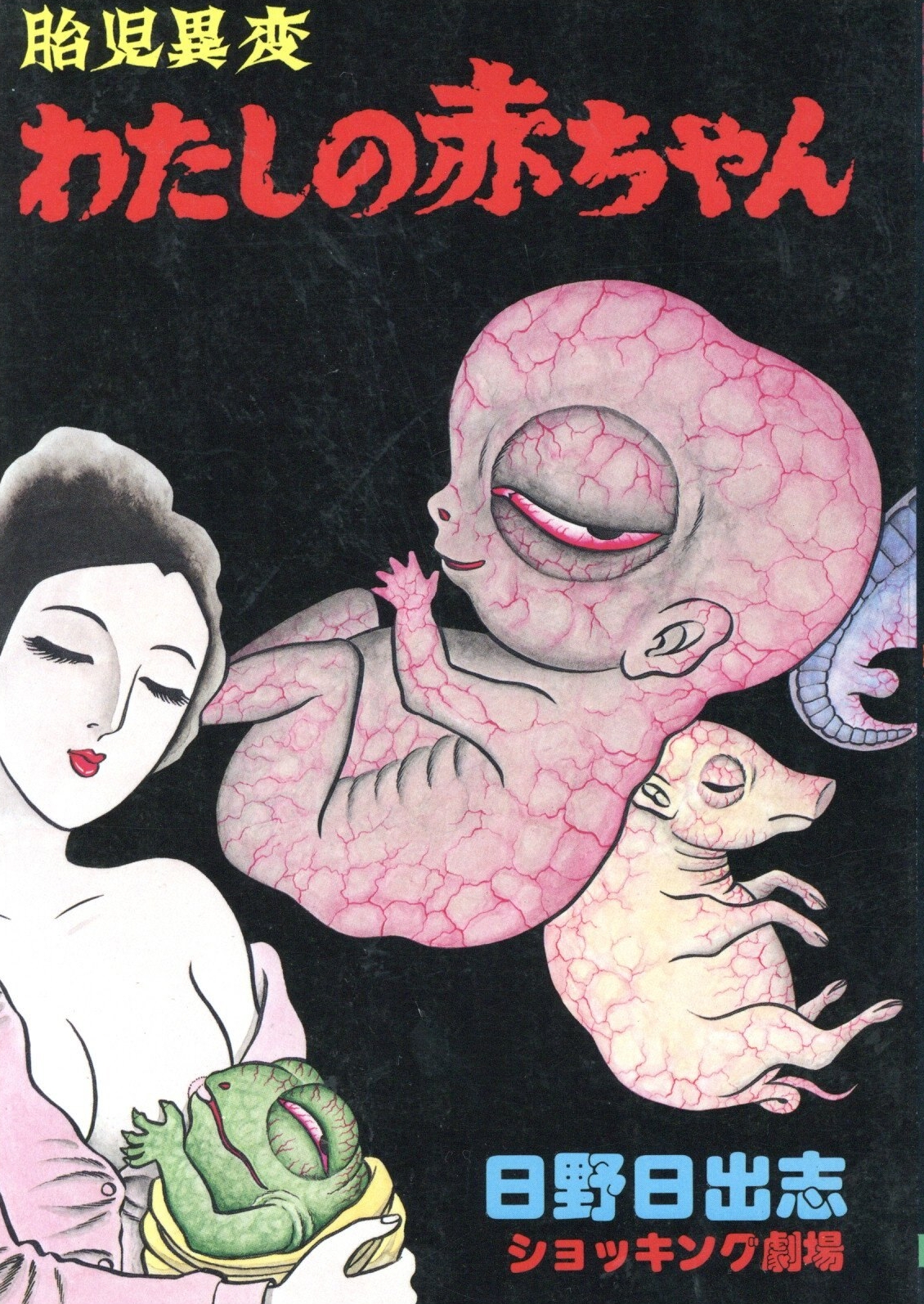 Unusual Fetus: My Baby